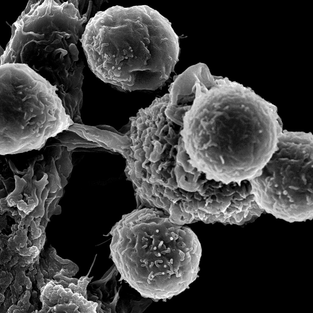 National Cancer Institute