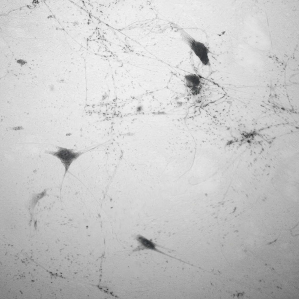 Microscope view of giant multipolar neuron